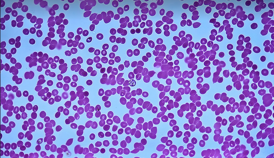 <p><span data-name="microscope" data-type="emoji">🔬</span><span data-name="petri_dish" data-type="emoji">🧫</span><strong><span> </span>Na podstawie zdjęcia preparatu:</strong></p><p></p><ul><li><p><span data-name="book" data-type="emoji">📖</span><span> </span>rozpoznaj gatunek pasożyta;</p></li></ul><p></p><ul><li><p><span data-name="recycle" data-type="emoji">♻</span><span> </span>rozpoznaj wszystkie formy rozwojowe;</p></li></ul><p></p><ul><li><p><span data-name="microbe" data-type="emoji">🦠</span><span> </span>wskaż organelle i cechy charakterystyczne dla danego gatunku;</p></li></ul><p></p><ul><li><p><span data-name="mask" data-type="emoji">😷</span><span> </span>nazwij chorobę, którą pasożyt wywołuje.</p></li></ul><p></p>