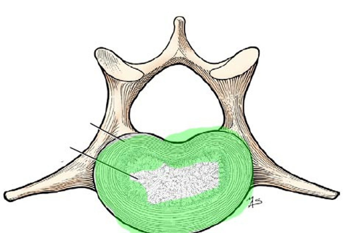 <p>outer ring of fibrocartilage that surrounds nucleus pulposus</p><p>*mostly avascular and aneural (except very outermost layers) </p>