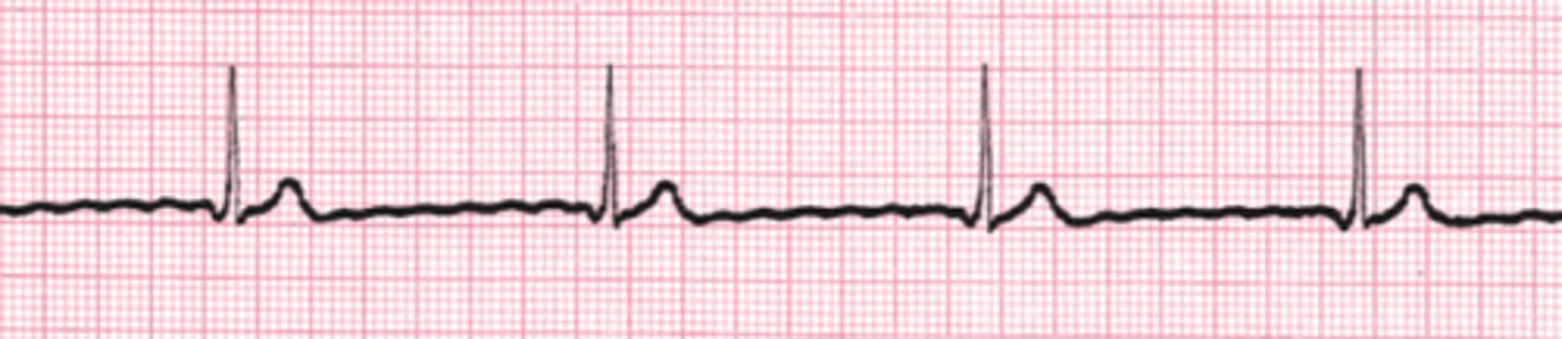 <p>Name the rhythm</p>
