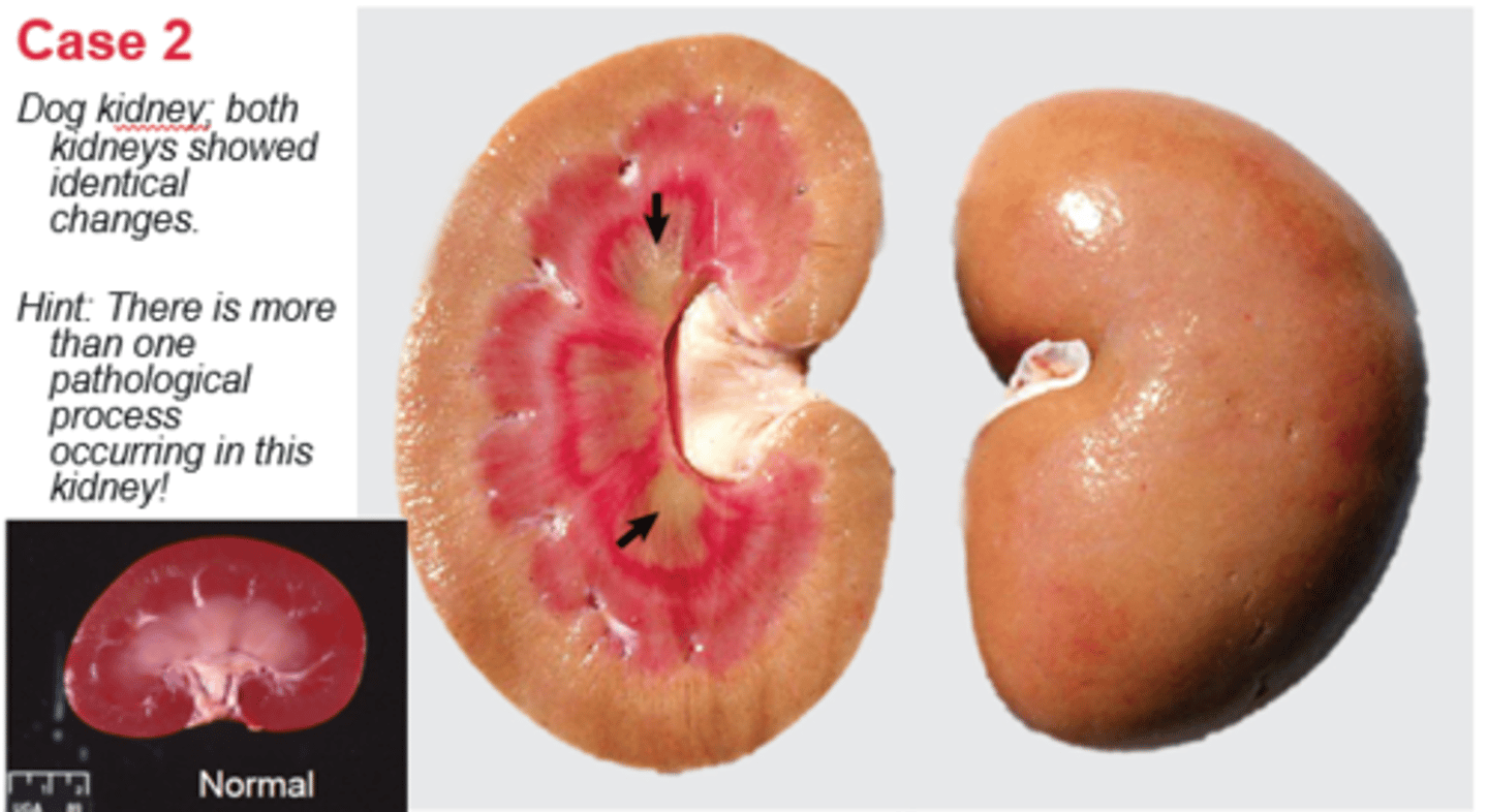 <p>These are the tips at the base of the renal pyramids which project into a minor calyx. These structures drain urine from the pyramids into the minor calyxes.</p>