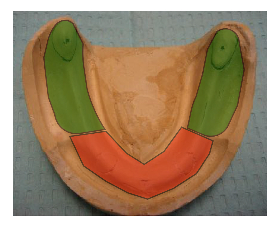 <p>what area is shaded in orange?</p>