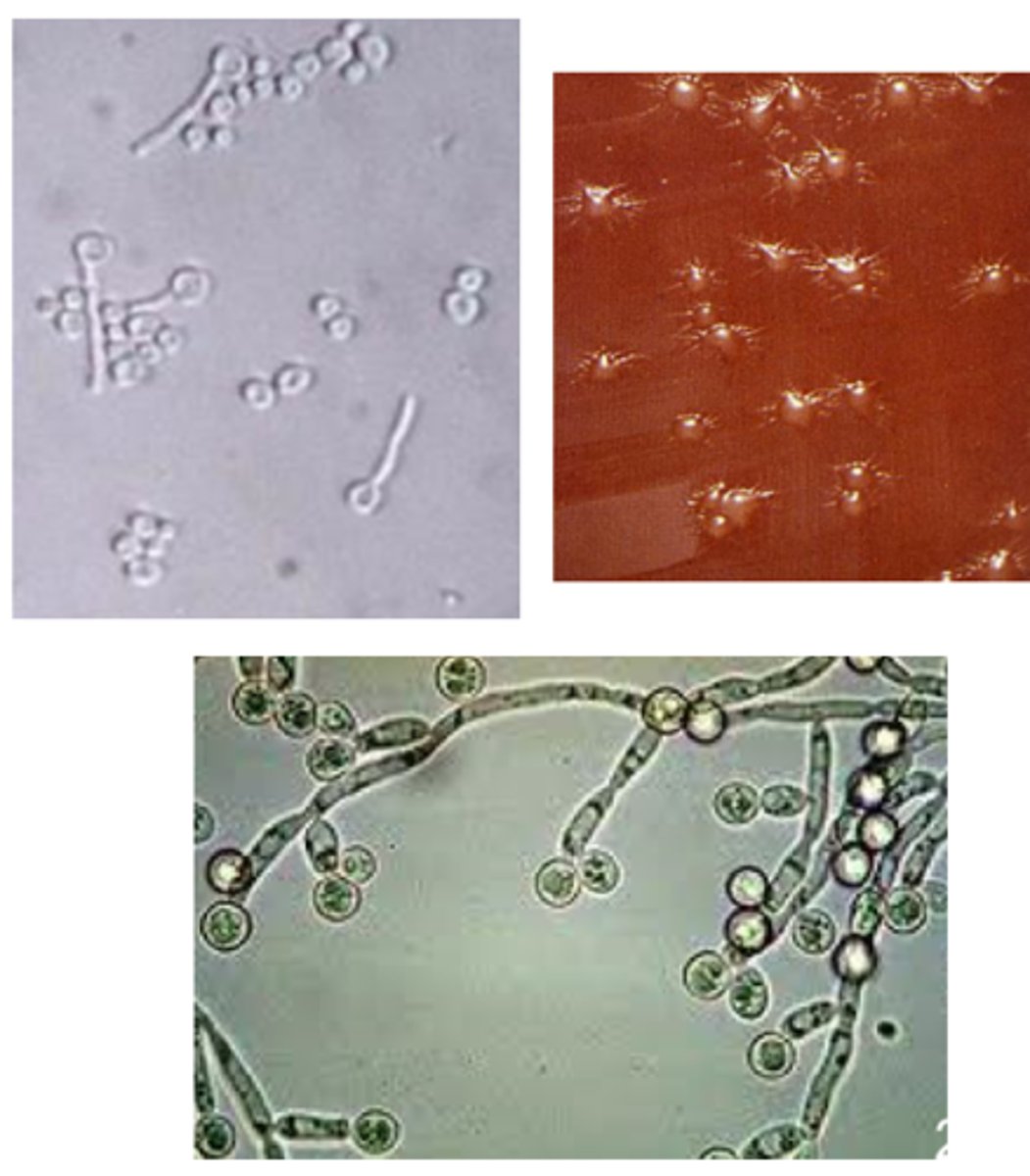 <p>· Normal flora (small numbers) in skin, vagina, oral cavity, and intestine</p><p>· Finger-like or star-like projections on blood agar</p><p>· Most common species isolated from all forms of candidiasis</p><p>· Contiguous germ tube formed from incubation of colony in serum</p><p>· Distinctive morphology on chromogenic medium</p><p>· Terminal chlamydocondia, especially at 25C</p>