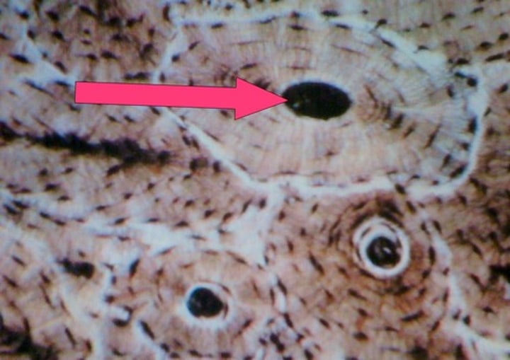 <p>-in the center of each osteon. It contains blood vessels.</p>