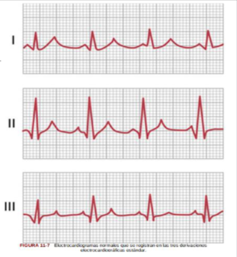 <p>Derivación I (cuando el punto en el que el brazo derecho se conecta con el tórax es electronegativo respecto al \n punto en el que se conecta el brazo izquierdo el electrocardiógrafo registra una señal positiva), II (cuando el brazo derecho es negativo respecto a la pierna izquierda, el electrocardiógrafo registra una señal positiva), y III (el electrocardiógrafo registra una señal positiva cuando el brazo izquierdo es negativo respecto a la pierna izquierda).</p>