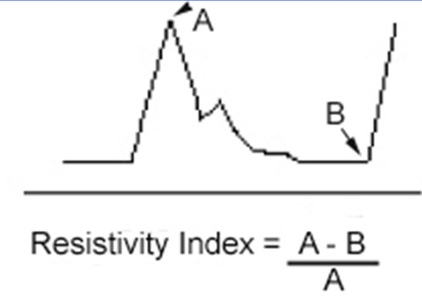 <p>Resistance of the end/target organ</p>