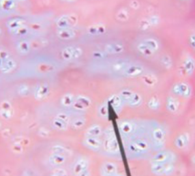 <p>what kind of cartilage is this </p>