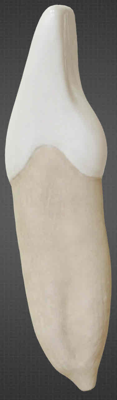 <p>what is the root structure of the mandibular central incisor?</p>
