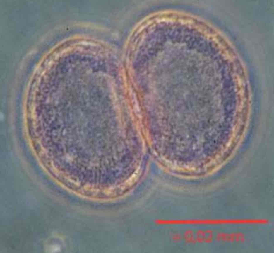 <p>Per scissione binaria, le forme tecate possono dividere le piastre della teca tra le due cellule figlie, oppure la teca viene persa e le cellule figlie sintetizzano tutta la teca</p>