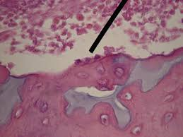 <p>Bone-forming cell that secretes bone matrix.</p>