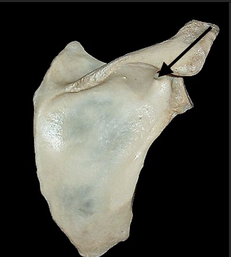 <p>Identify structure </p>