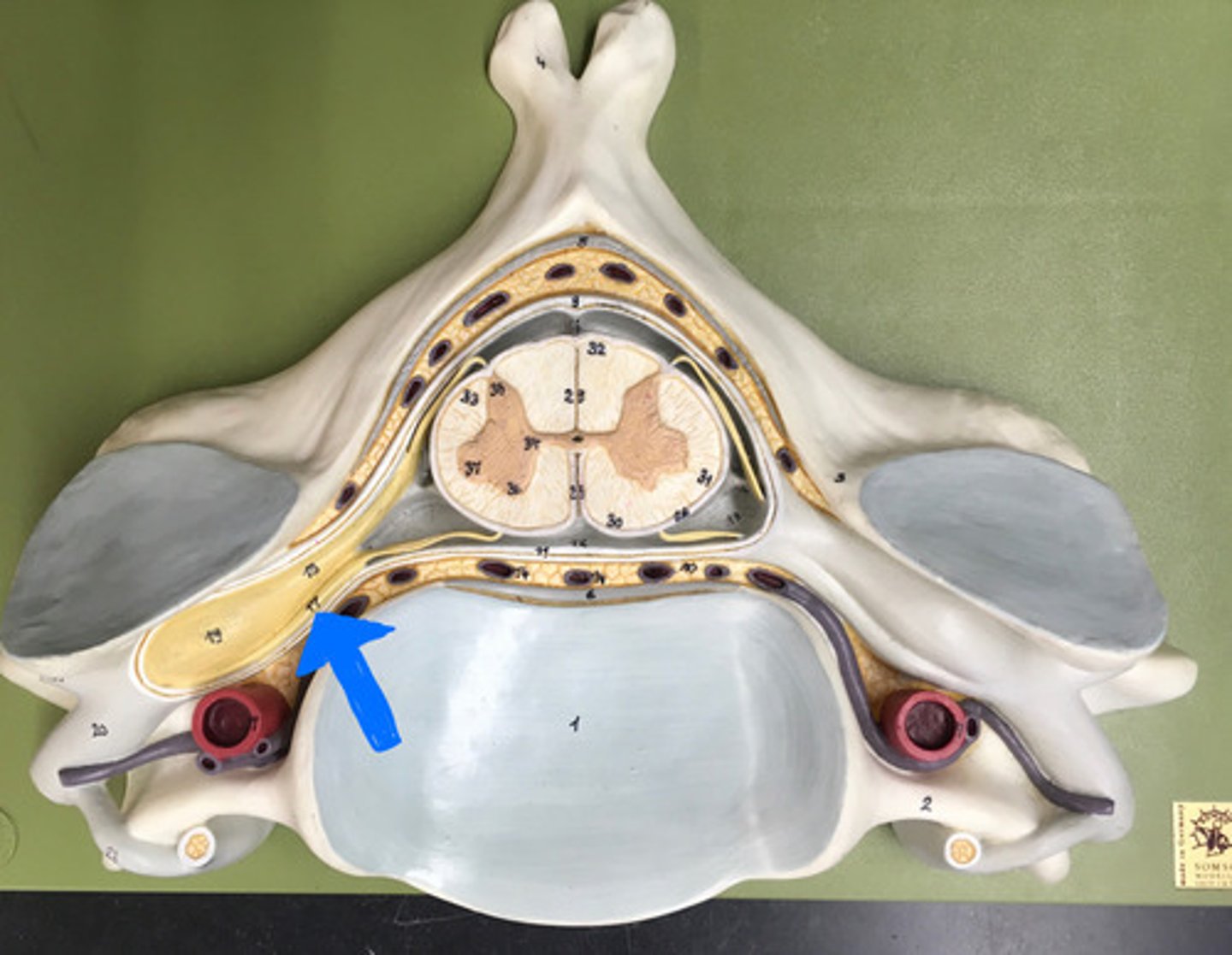 <p>axons of motor neurons</p>