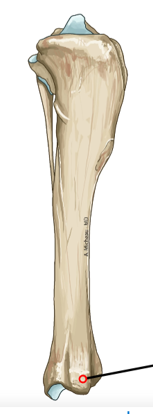<p>Medial distal prominence; ligament attachment.</p>