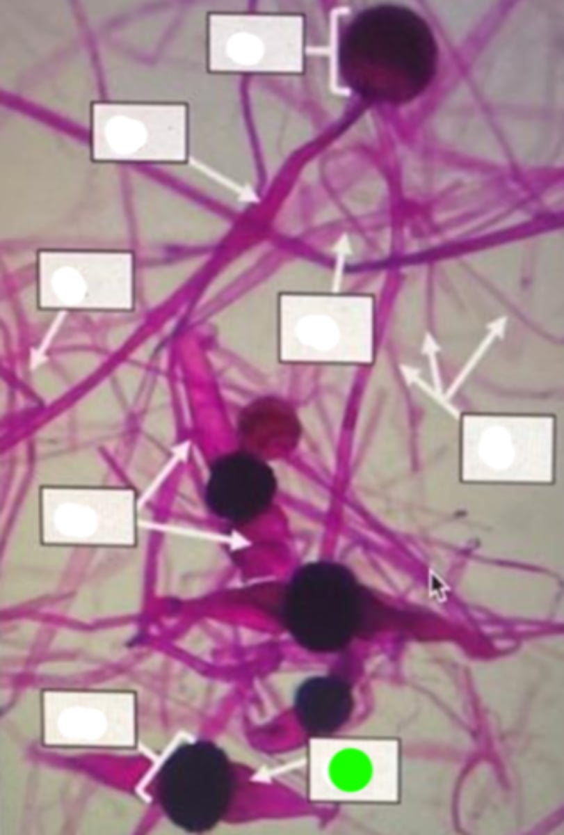 <p>A thick-walled structure formed from the fusion of specialized hyphae during sexual reproduction, providing protection for the dormant zygospores.</p>