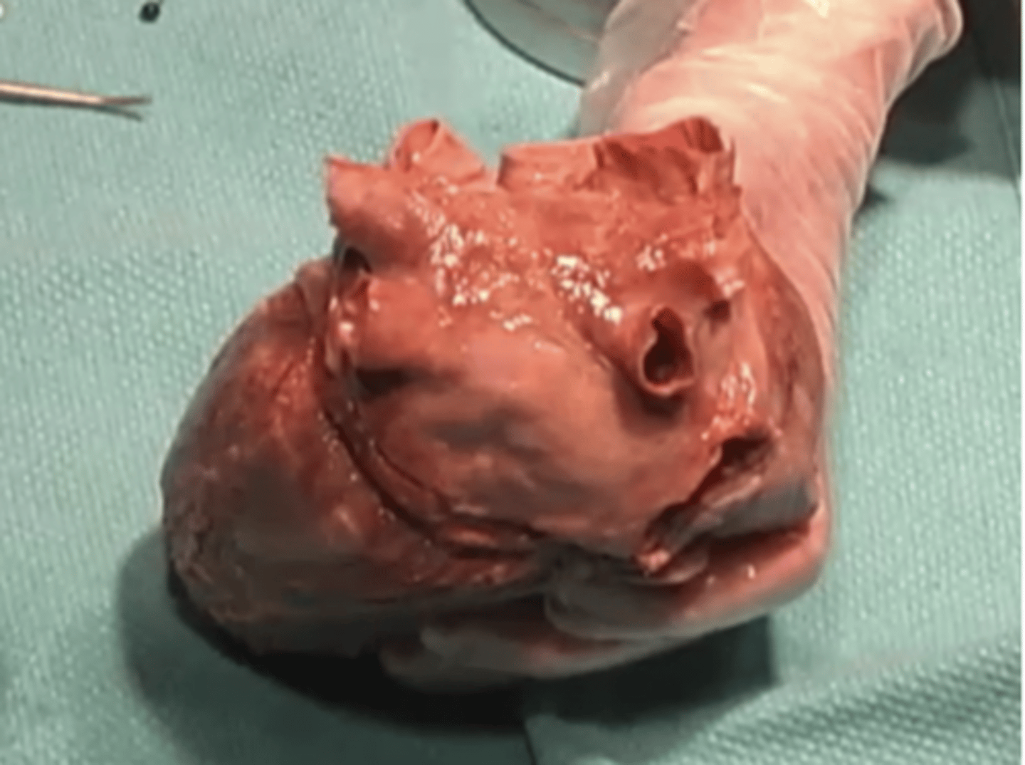 <p>How many pulmonary veins are present?</p><p>2</p><p>4</p><p>1</p><p>3</p>