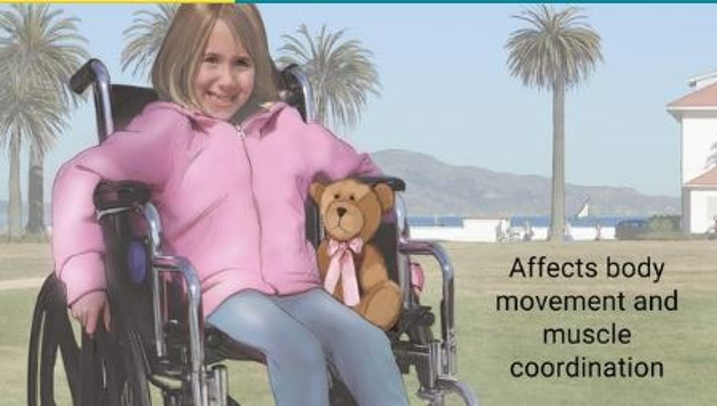 <p>A condition characterized by paralysis, weakness, lack of coordination and other type of motor problems; caused by damage to parts of the brain, before, during or shortly after birth; some individuals have mental retardation and some do not. The severity depends on the parts of the brain that are damaged and the extent to which they are damaged.</p>
