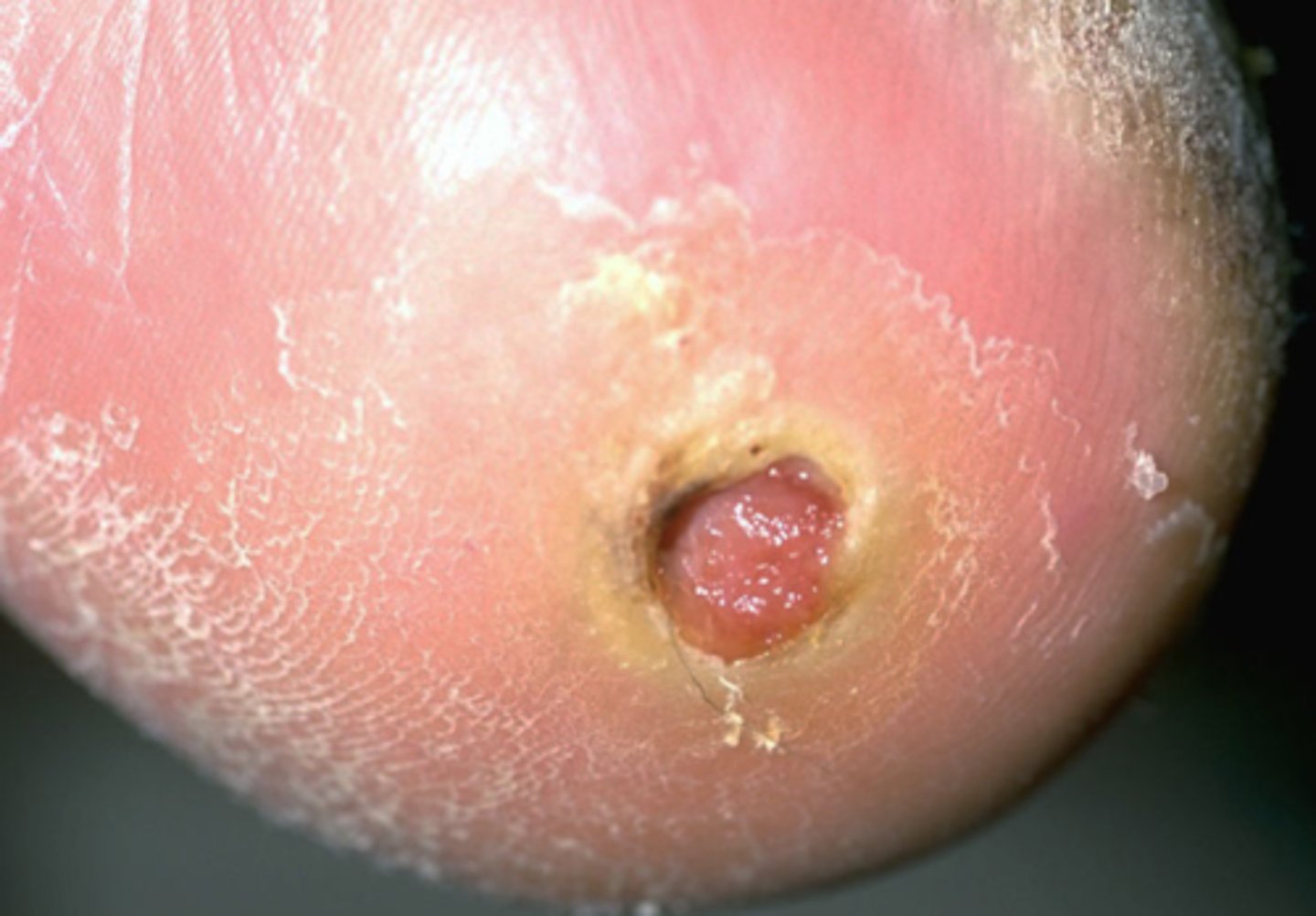 <p>What is the diagnosis?</p>