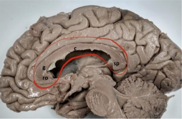 <p>Region that allows information from one hemisphere to travel to another hemisphere</p>