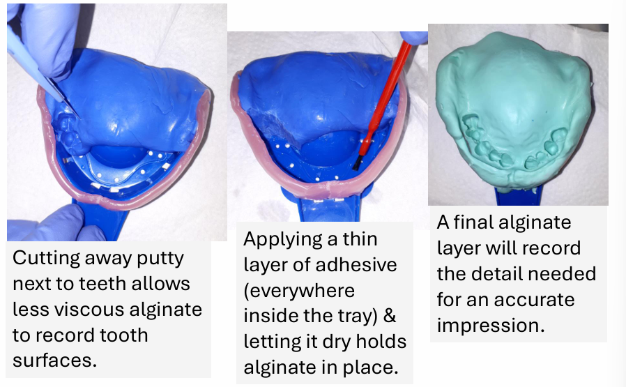 <p>You cut away the putty to leave some room for the less viscous alginate to get a more detailed impression of the teeth</p>