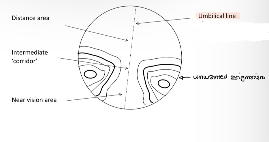 <p>Using the umbilical line which eye is this lens for </p>
