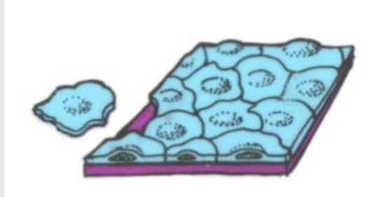 <p>Simple squamous epithelium</p>