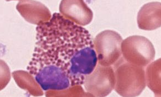 <p>eosinophils</p>