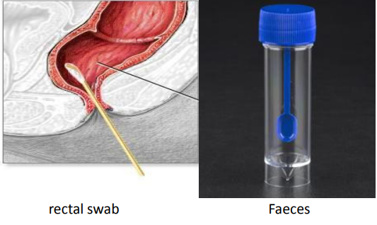 <p>rectal swap used in cases of infective diarrhea, cholera chronic diarrhea </p><p>faeces (much better specimen than a rectal swap) used in acute intestinal infection</p>