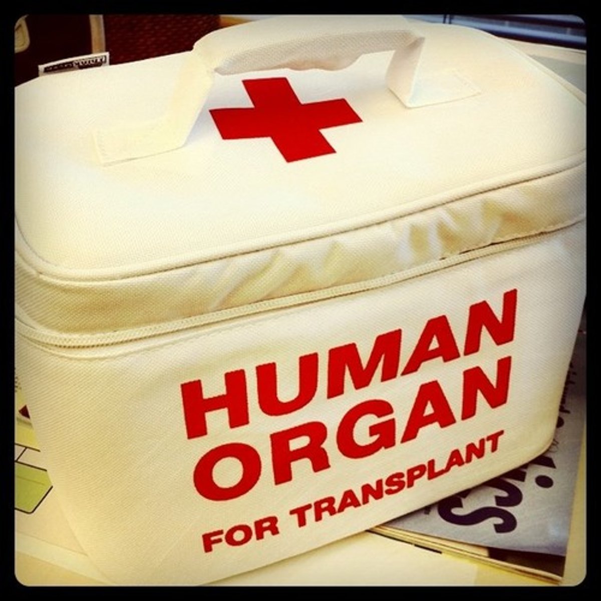 <p>transplant</p>