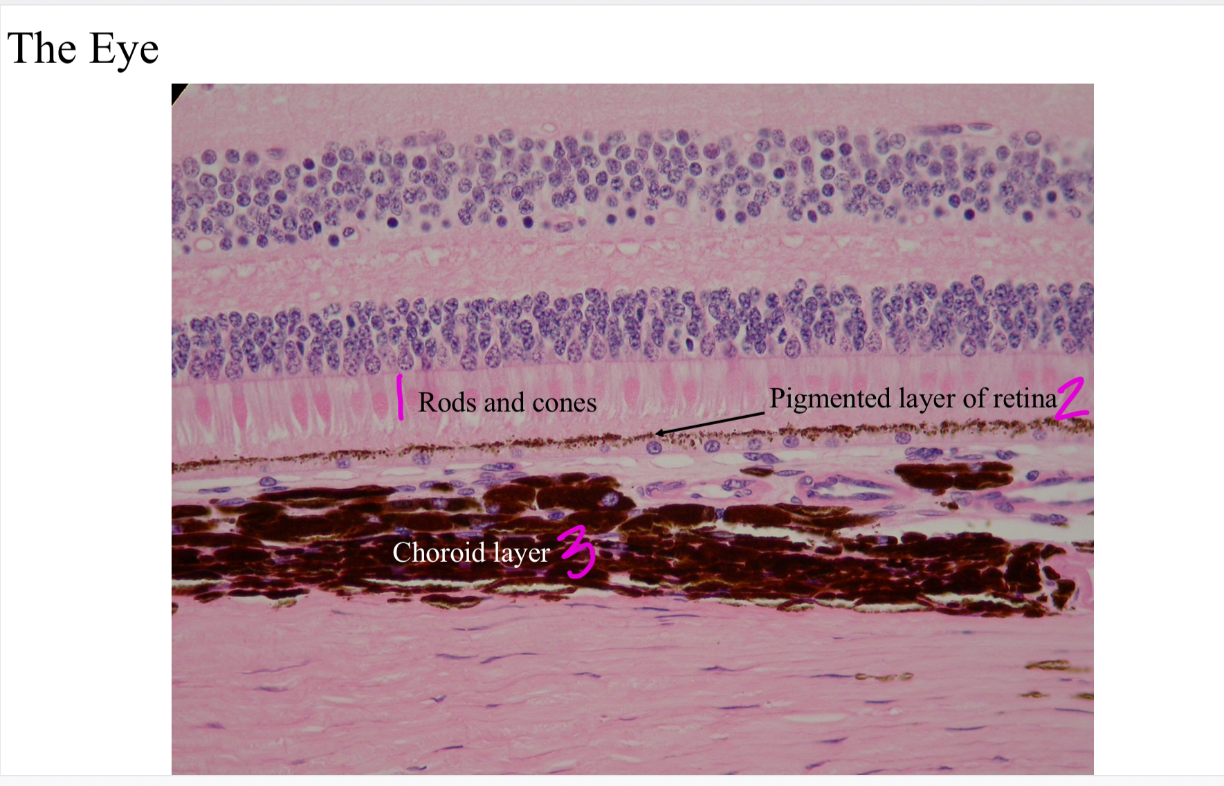 <ol><li><p>Rods &amp; cones</p></li><li><p>Pigmented layer of retina</p></li><li><p>Choroid layer</p></li></ol>