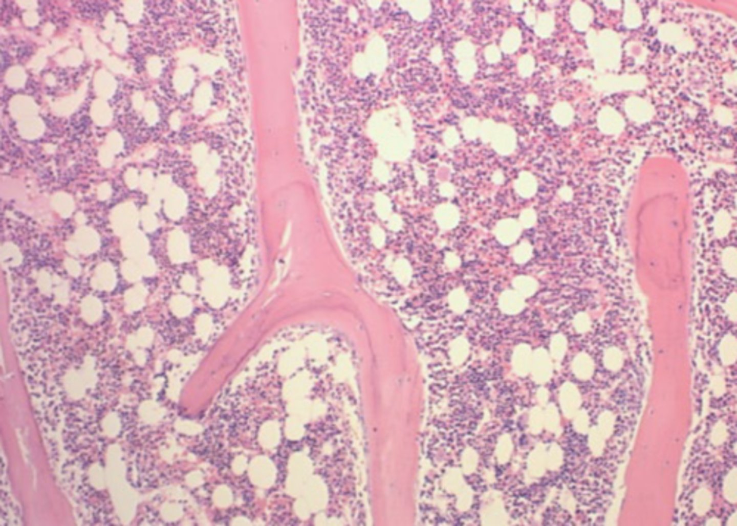 <p>- "big picture" and architecture: degree of cellularity, fibrosis, necrosis, large pockets of neoplastic cells</p>