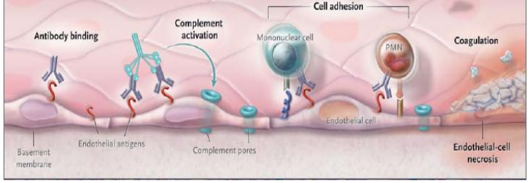 <p>complement system and clotting system&nbsp;</p><p>leading to necrosis and failure</p>