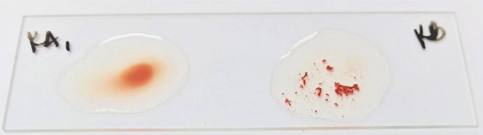 <p>Identify the:</p><ul><li><p>Blood Group</p></li><li><p>Antibody/Antibodies Present</p></li><li><p>Antigen(s) Present</p></li></ul><p></p>