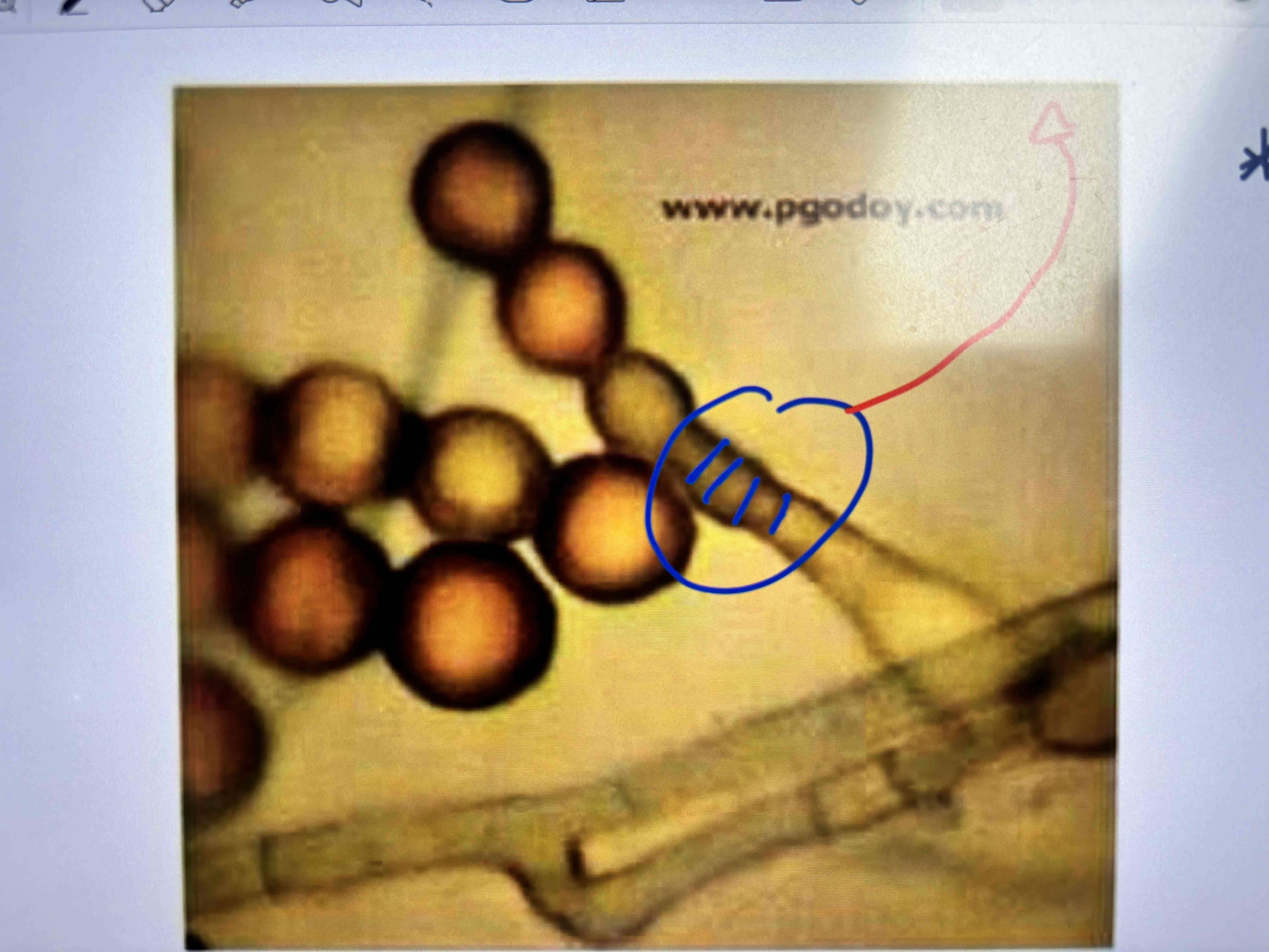 <p>Anelosporas</p>