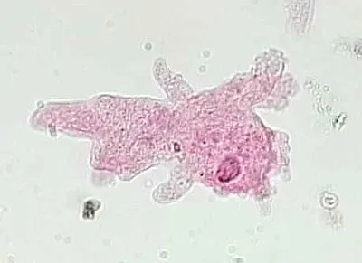 <p>Which protist is this?</p>
