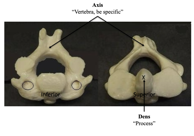 <p>Axis</p>