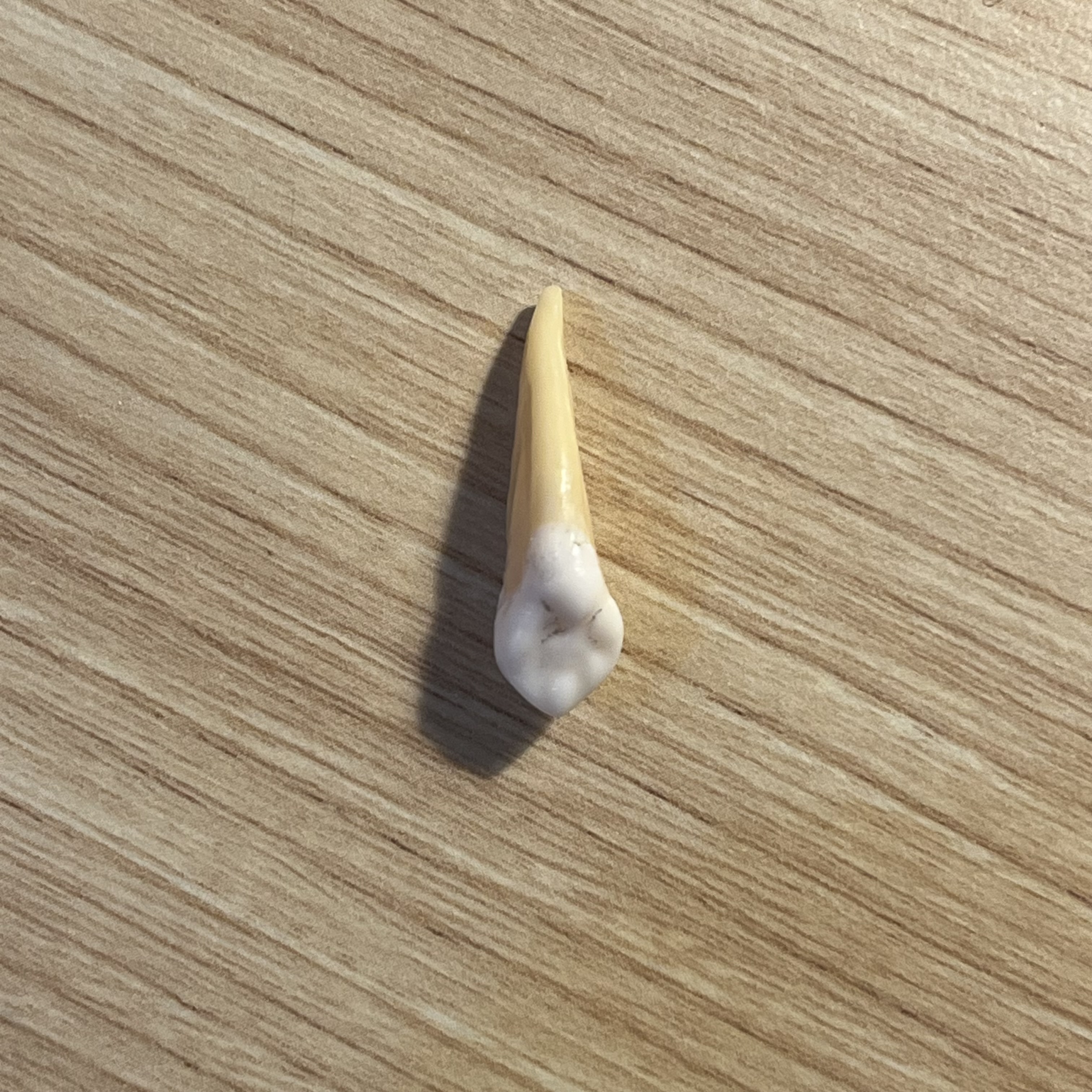 <p>What tooth is this (with view)?</p>