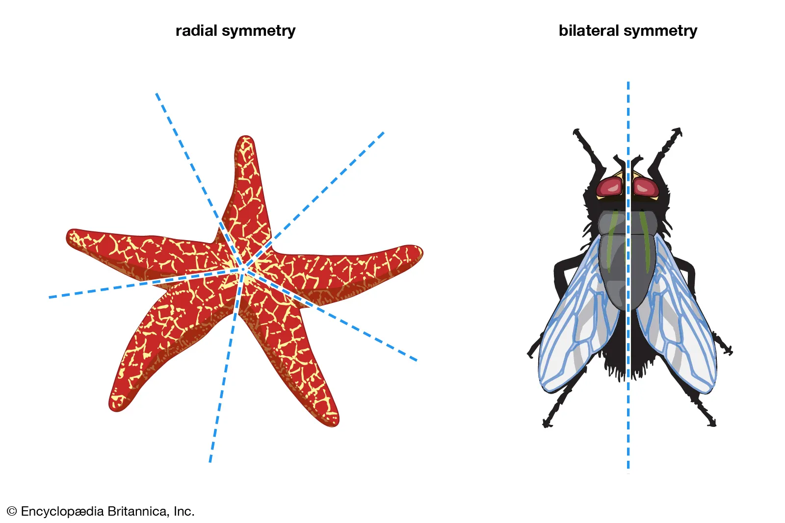 <p>Radial, Bilateral </p>