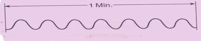 <p>What type of breathing is this?</p>