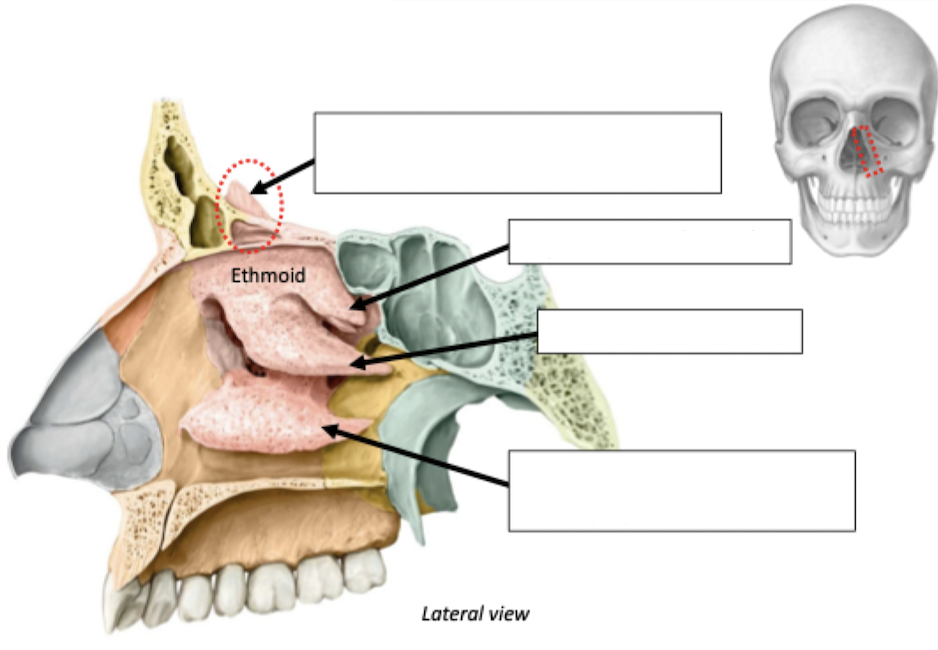 <p>Ethmoid Features</p>