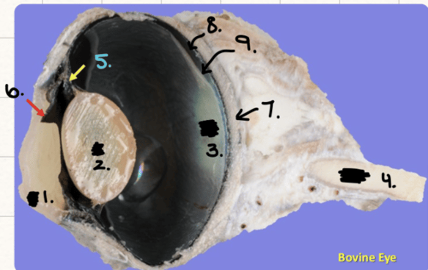 <p>what structure is labeled as #1 ?</p>