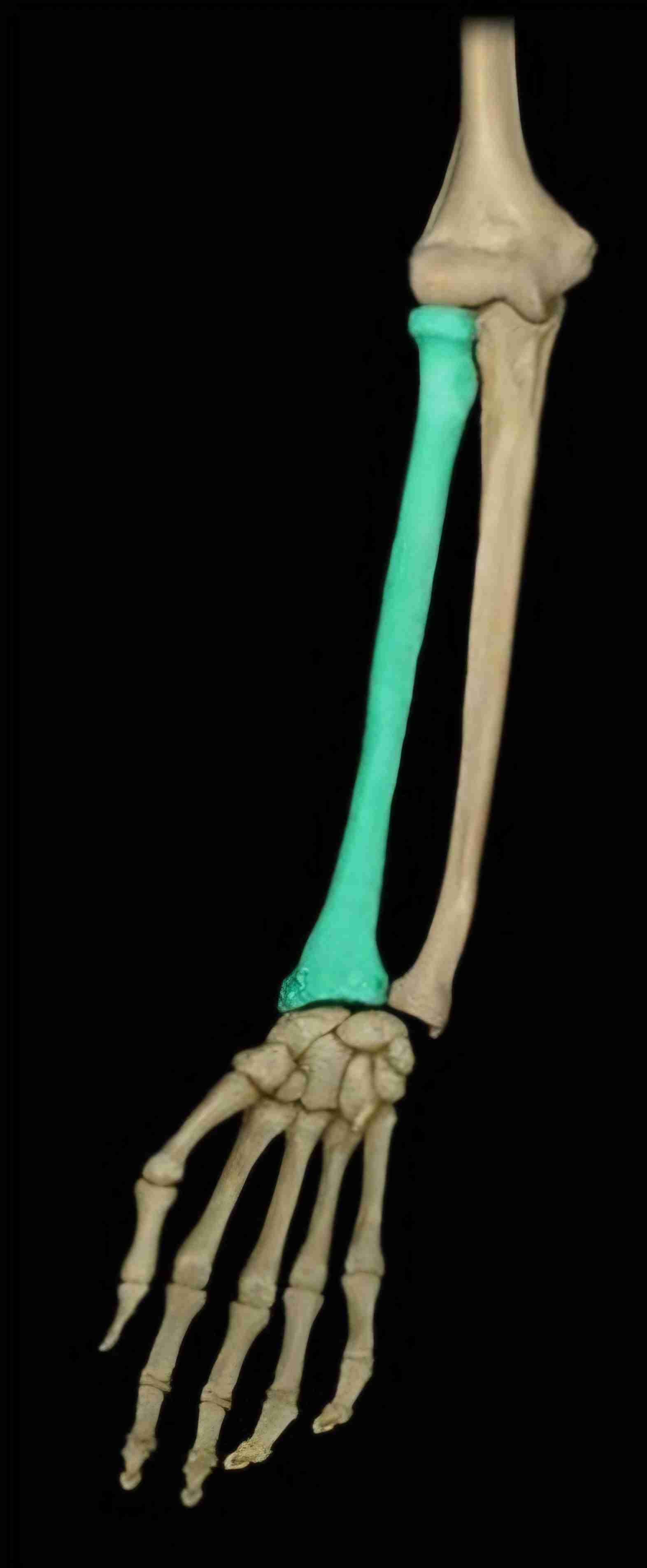 <p>What bone is this?</p>