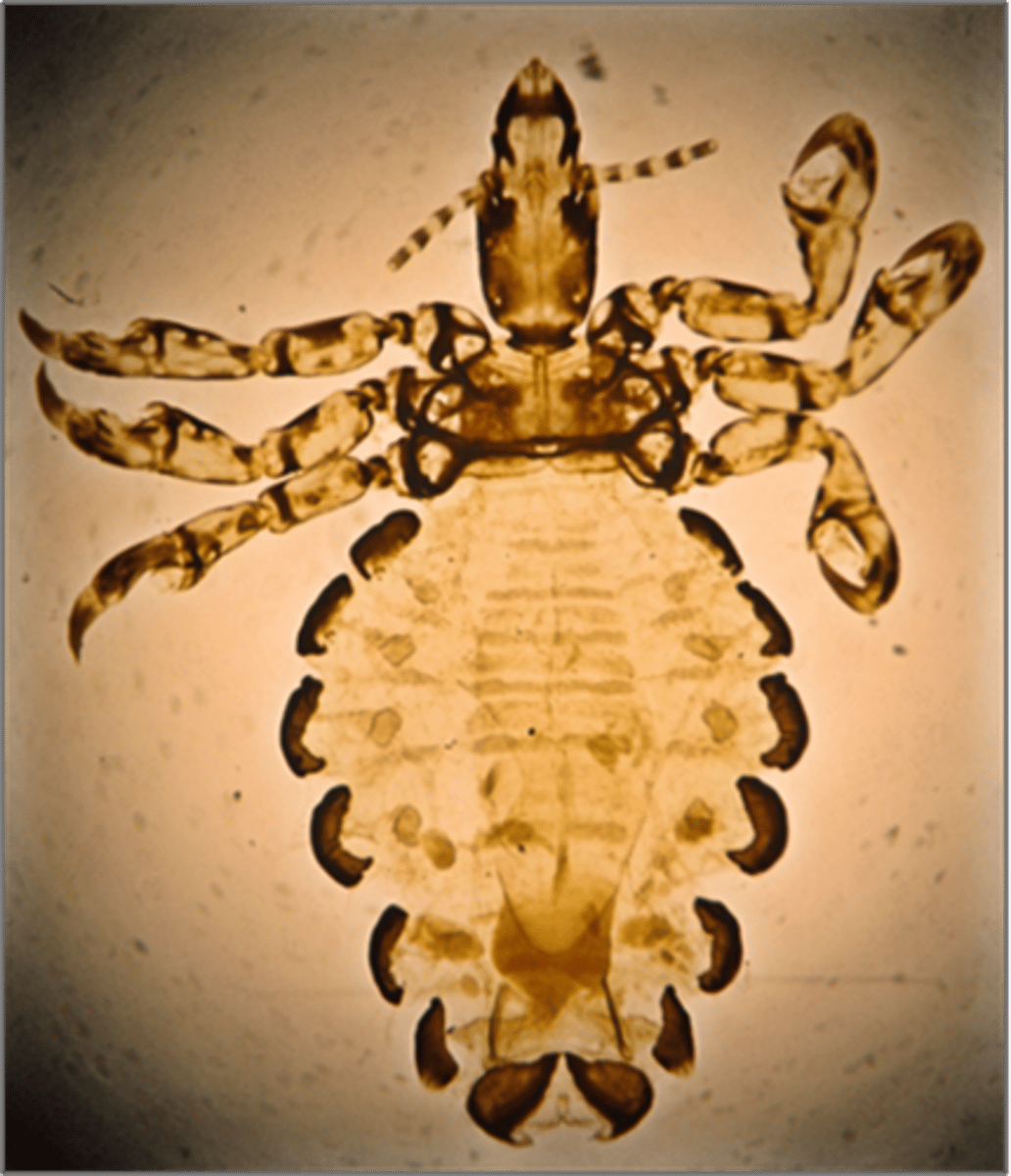 <p>Found in a piglet with intense pruritus and poor growth rates. What parasite is this?</p>