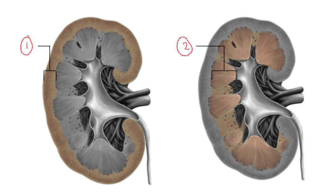 <p>Internal anatomy of kidney</p>