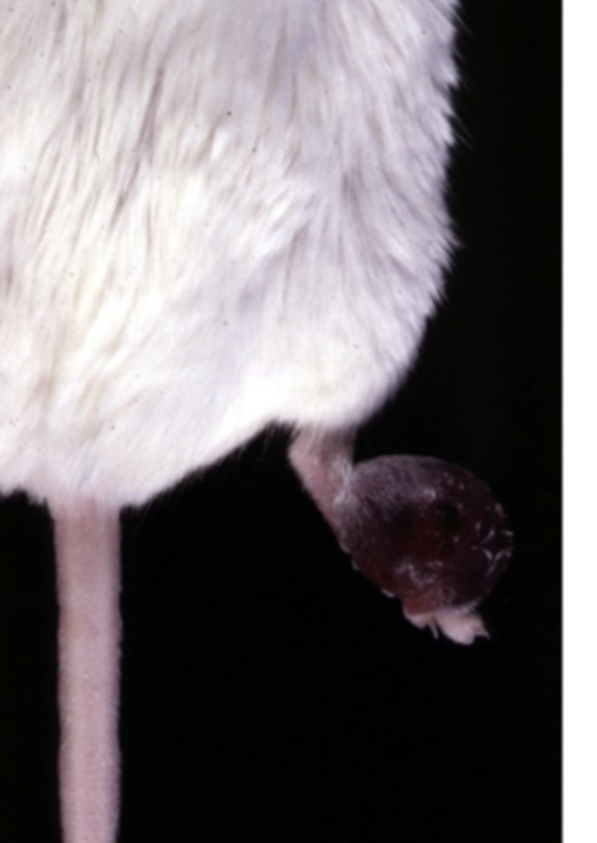 <p>What kind of tumor is this?</p>