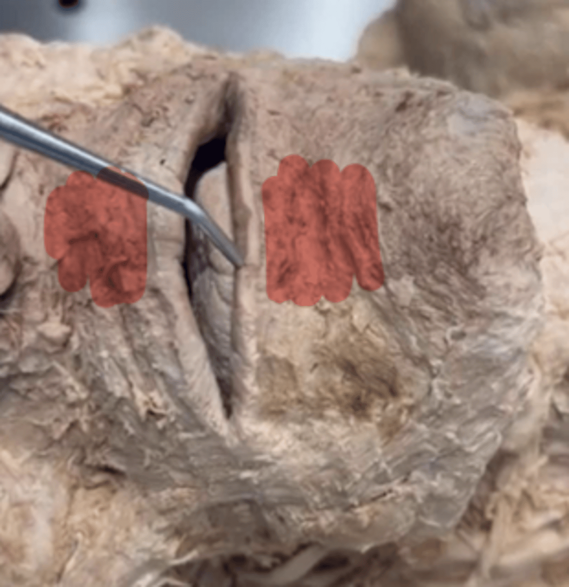 <p>Name the cavity.</p>