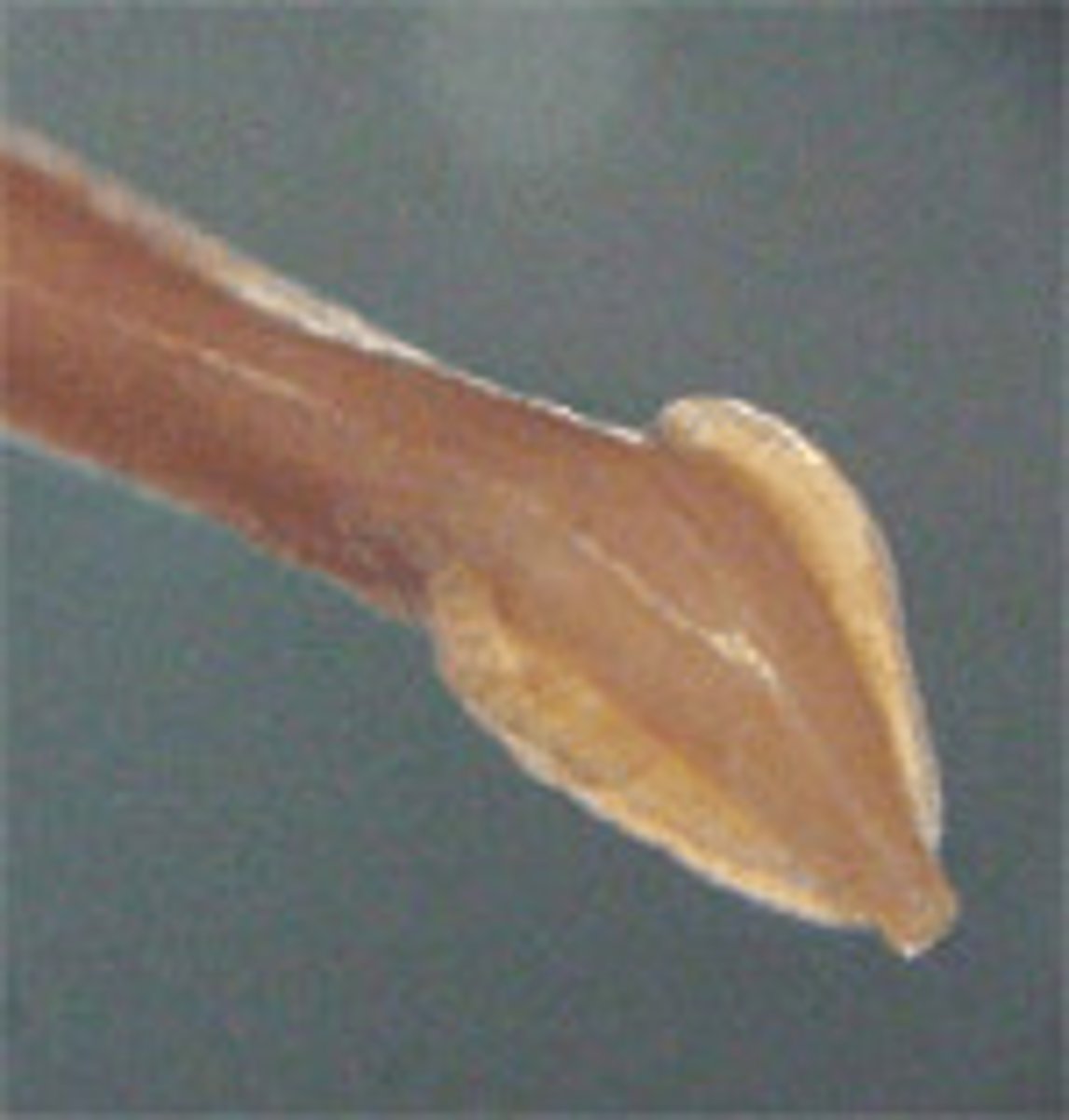 <p>What is this parasite is this if it is from a cat</p>