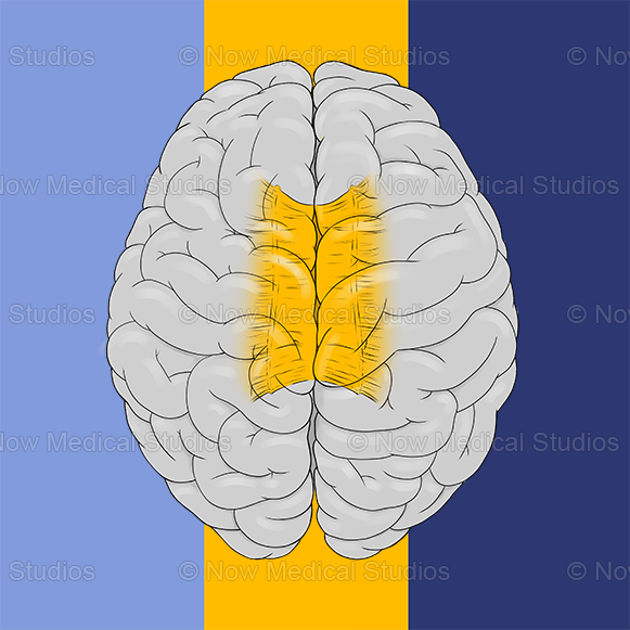 <p>White Matter Tract Connecting Left + Right Hemispheres</p>