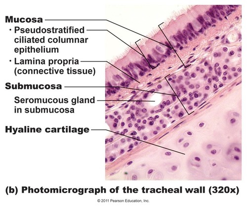 <p>ciliated pseudistratified columnar epithelium with goblet cells</p><p>lamina propria underneath epithelium contains elastic blood vessels</p>