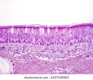 <p><strong>Picture example of pseudostratified epithelium tissue: </strong></p>
