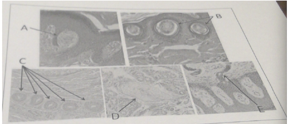 Histologically, \n Meissner’s corpuscles are commonly seen in neurofibromas of the gingiva. Which of the structures seen in the attachment represents the normal histology of a Meissner’s corpuscle