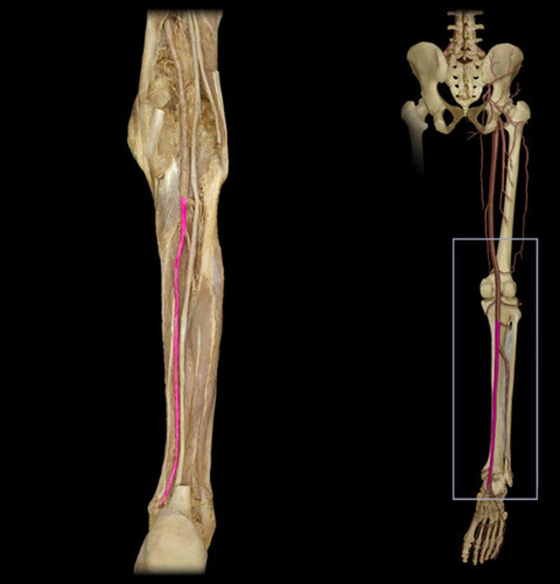 <p>Larger branch of the popliteal artery that supplies the posterior leg and foot. Under the triceps surae, flexor digitorum longus, and tibialis posterior. Medial to fibular artery.</p>